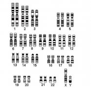 染色体异常概述